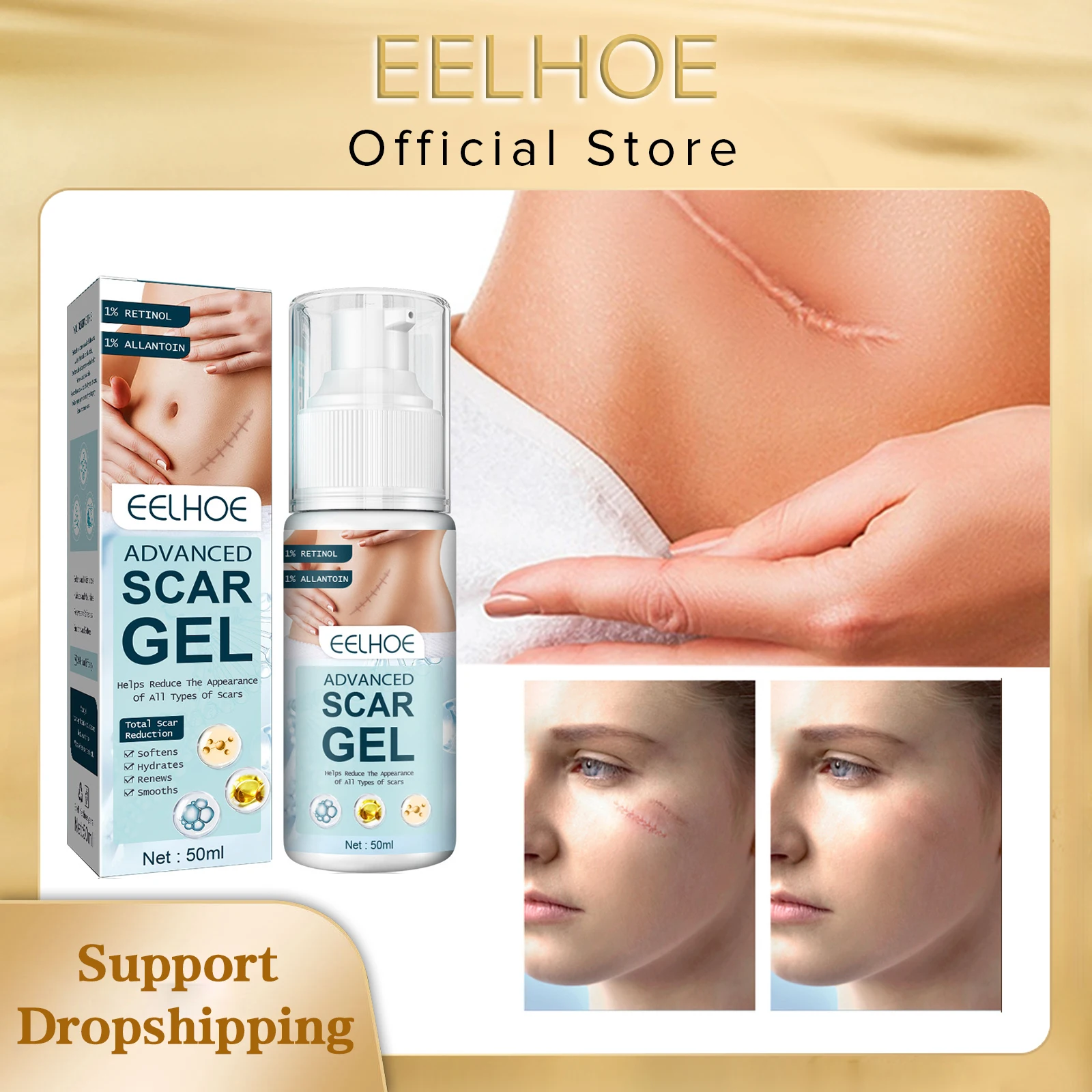 « Gel réparateur EELHOE : estompe cicatrices, brûlures, vergetures » – Test et Avis