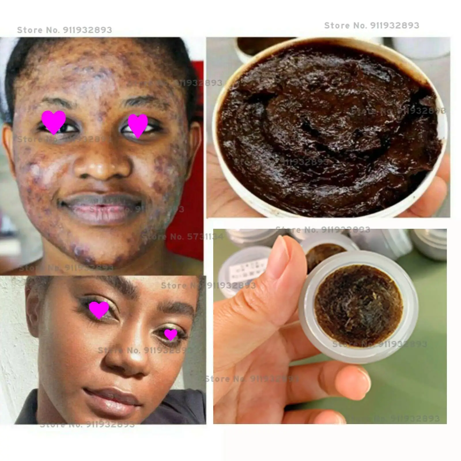 Savon noir végétal élimine acné et taches. – Test et Avis