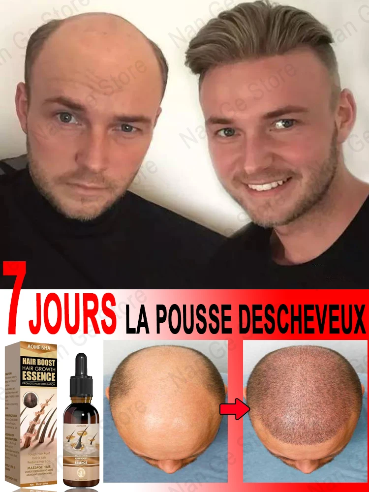 « Traitement capillaire unisexe pour croissance et réparation » – Test et Avis