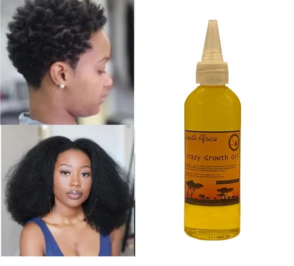 « Cheveux longs en 2 semaines grâce à l’huile de clou de girofle et de romarin » – Test et Avis