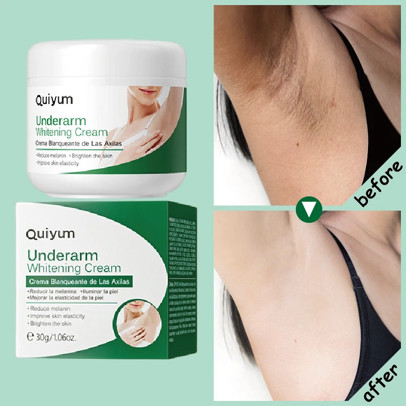 Crème Blanchissante pour le Corps et les Zones Sombres – Test et Avis