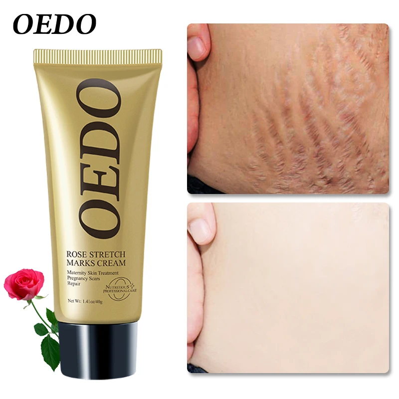 Crème Rose pour femmes enceintes et anti-âge. – Test et Avis