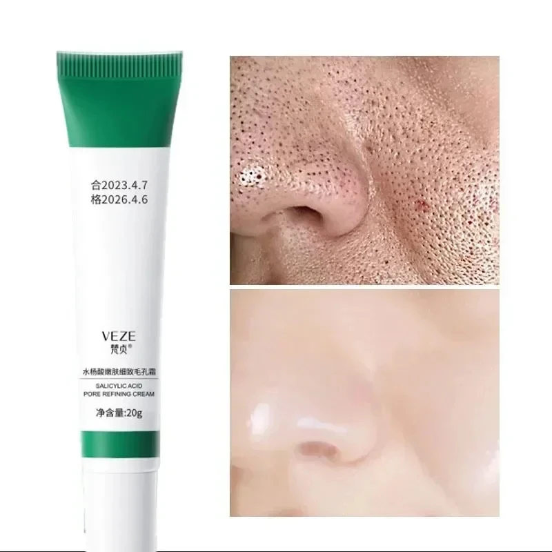 « Crème anti-acné et traitement des pores » – Test et Avis