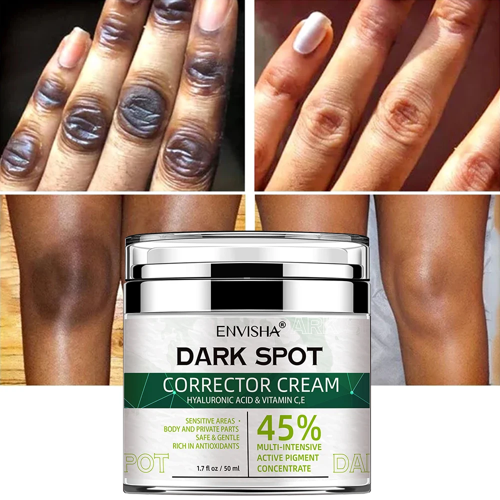 Crème blanchissante pour peau du visage. – Test et Avis