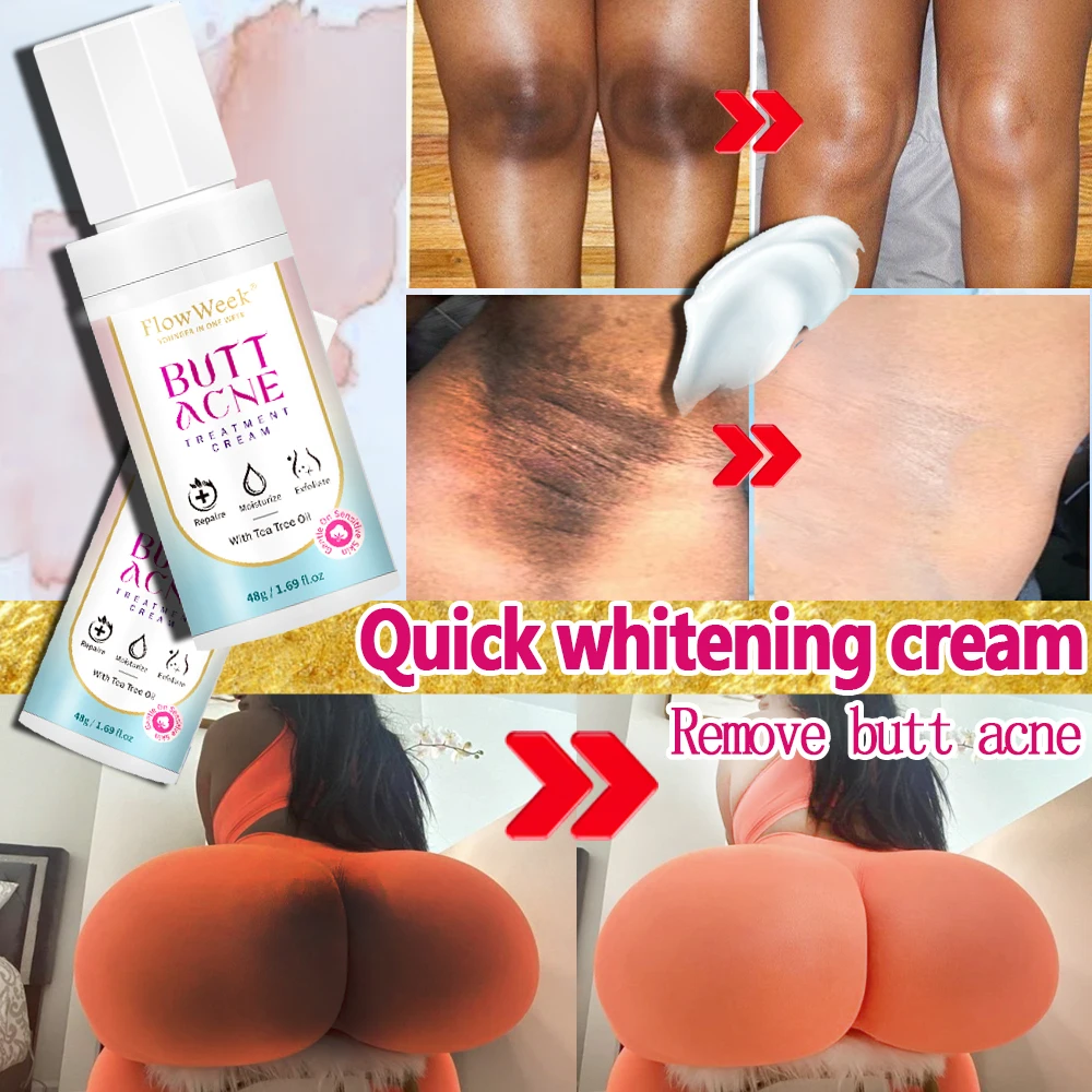 « Crème blanchissante : un soin complet pour le corps » – Test et Avis