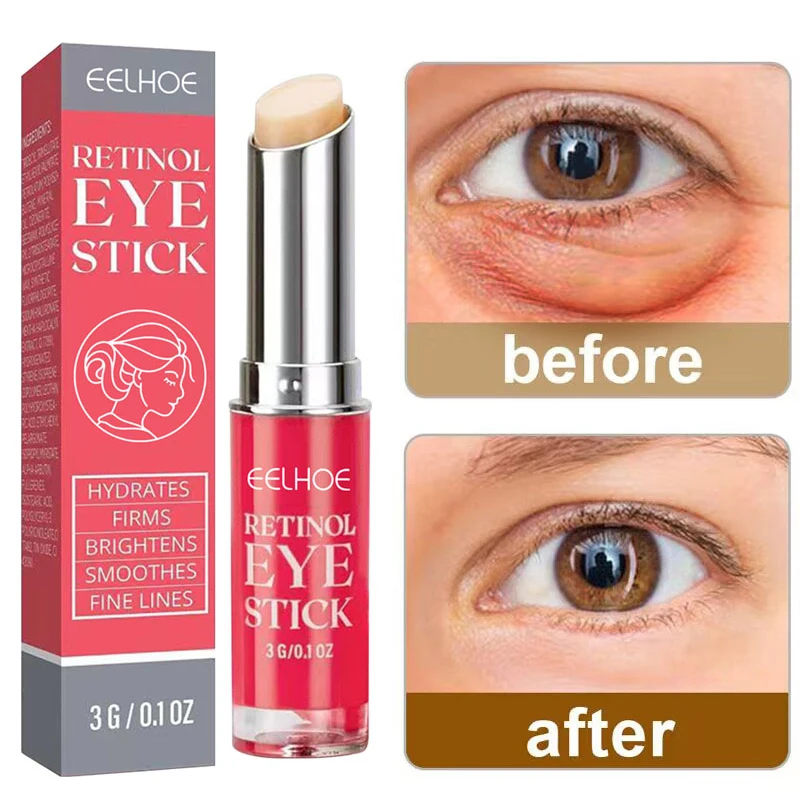 Crème pour les yeux anti-cernes et anti-rides. – Test et Avis
