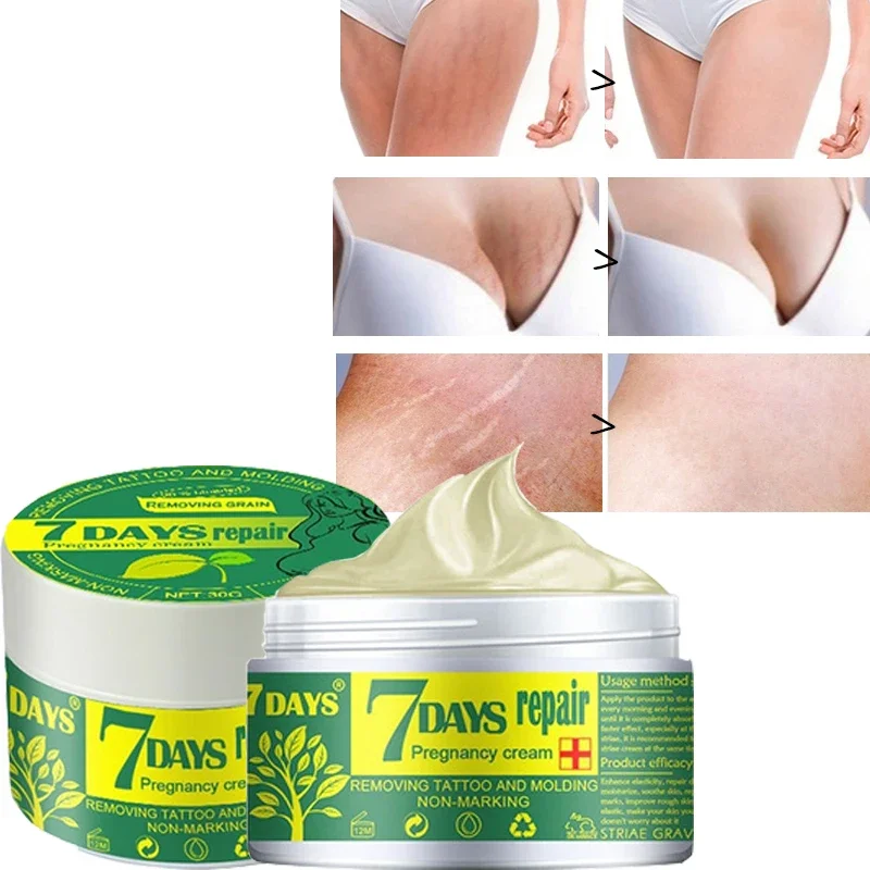 Crème réparatrice post-partum pour cicatrices, grossesse, obésité – Test et Avis
