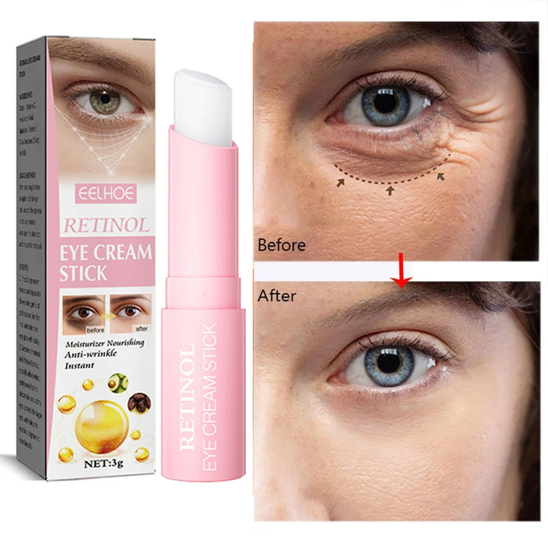 « Crème rétinol : remodelage instantané des yeux » – Test et Avis