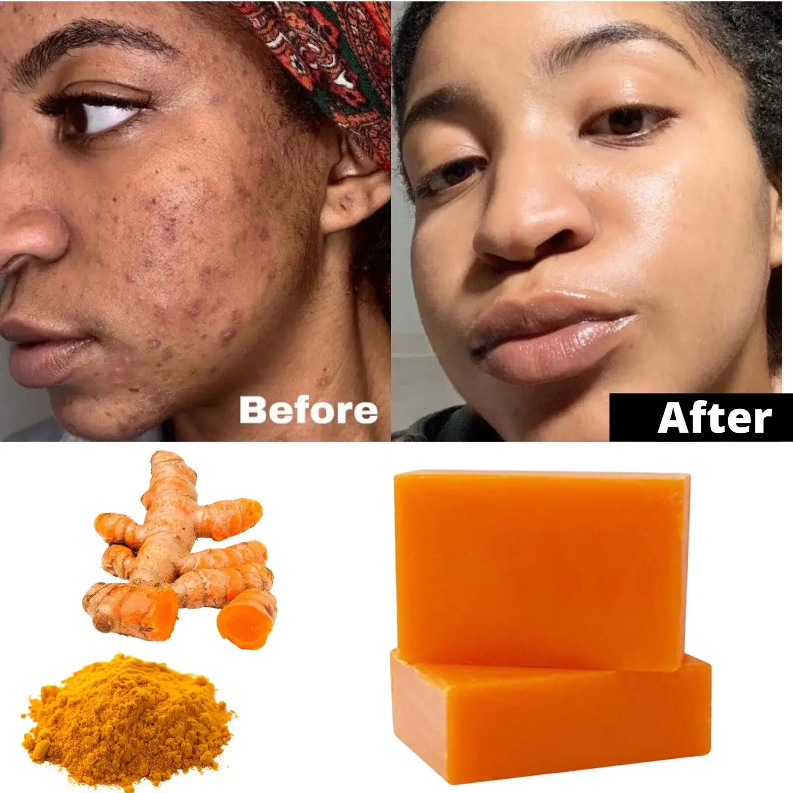 « Dissolvant taches foncées, défauts, acné : Kojic-Barre de curcuma Regina » – Test et Avis