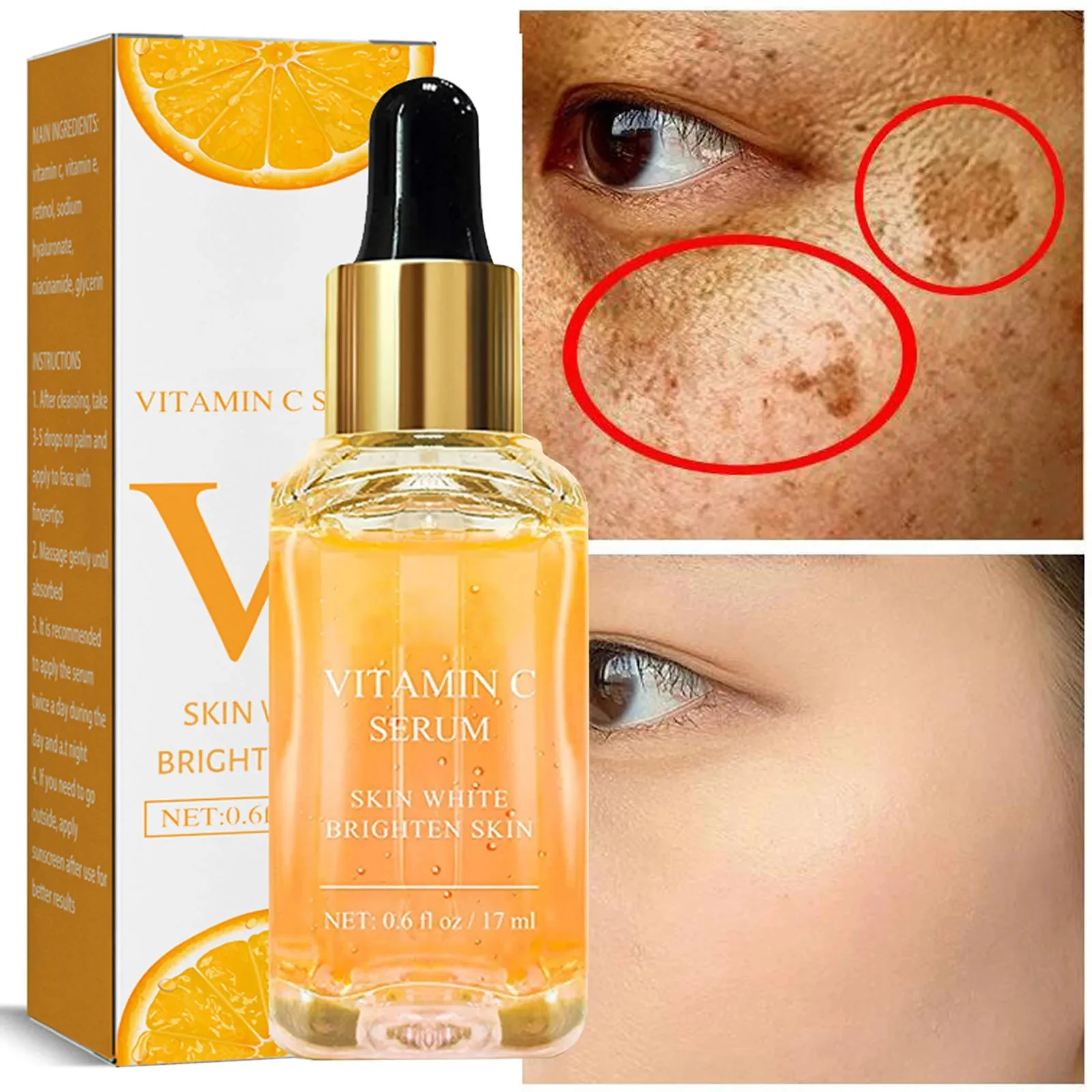 Éliminateur de taches brunes, rousseur, mélanine – Test et Avis