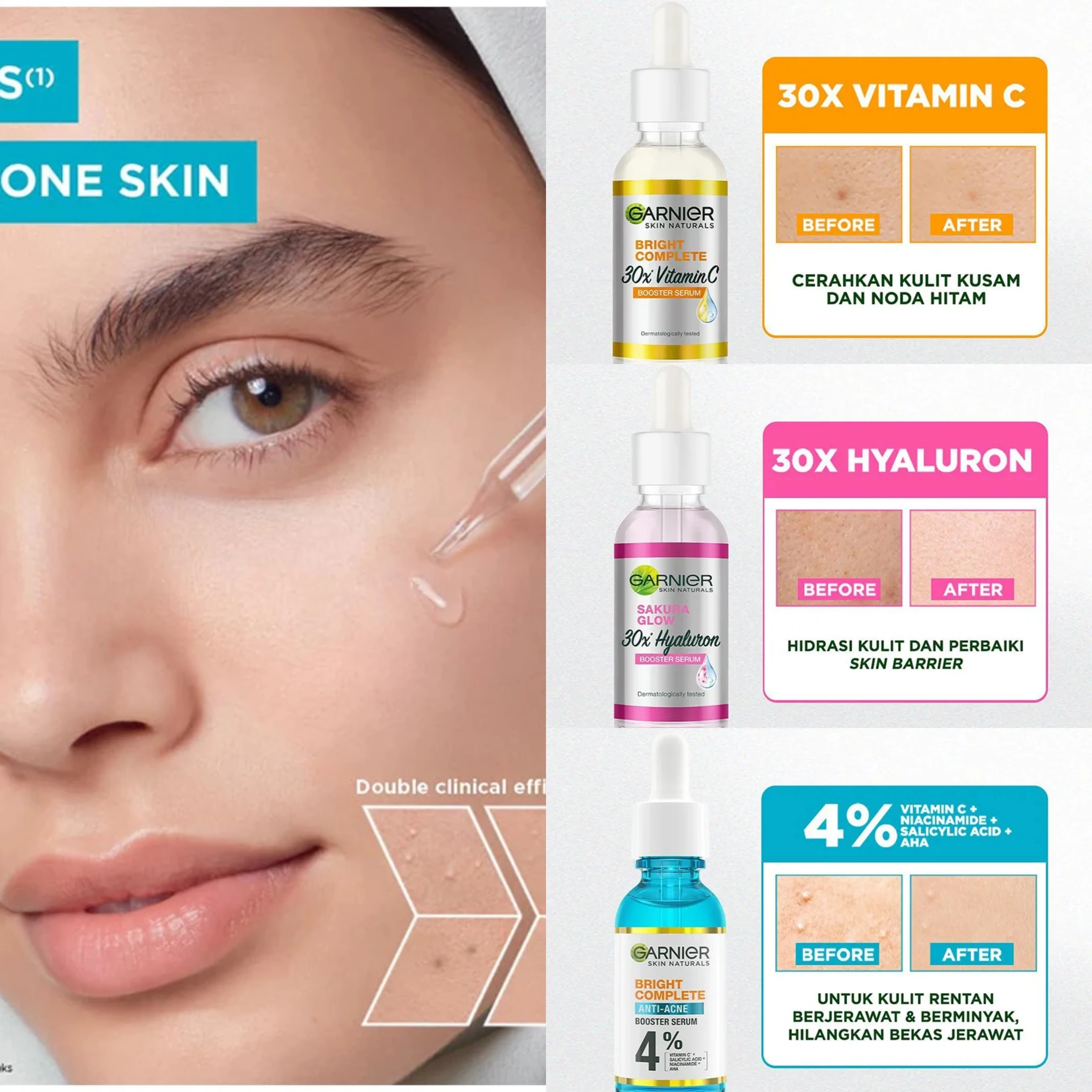 Garnier-Sérum blanchissant et réducteur de pores. – Test et Avis
