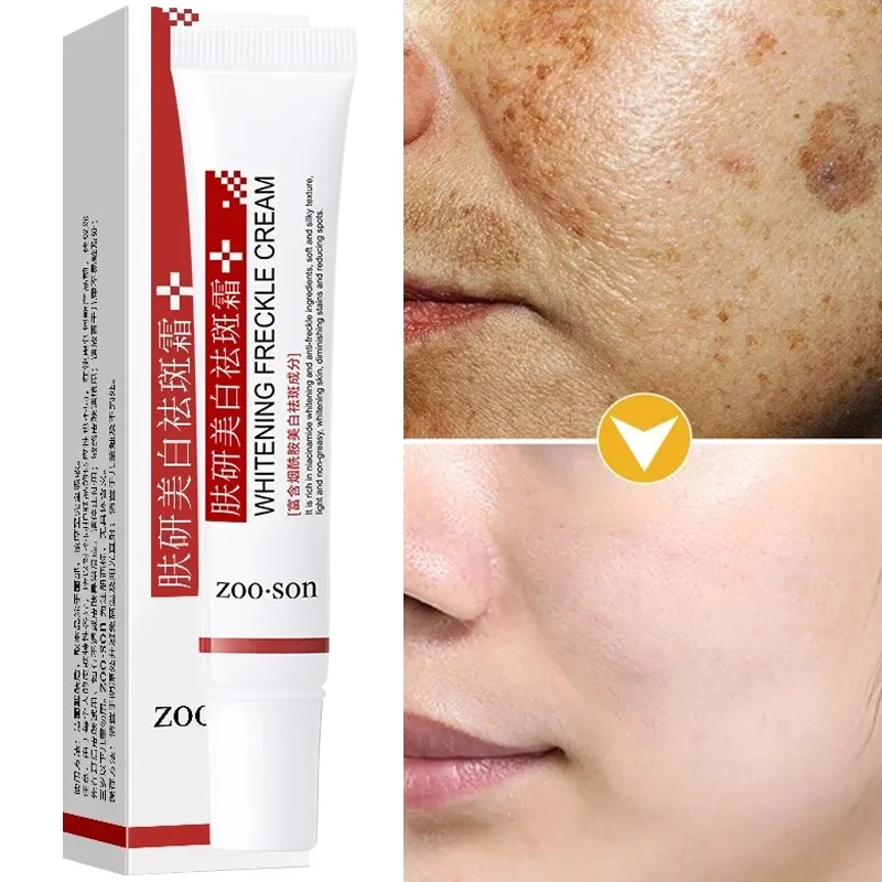 « Gel blanchissant élimine taches foncées pigmentées » – Test et Avis