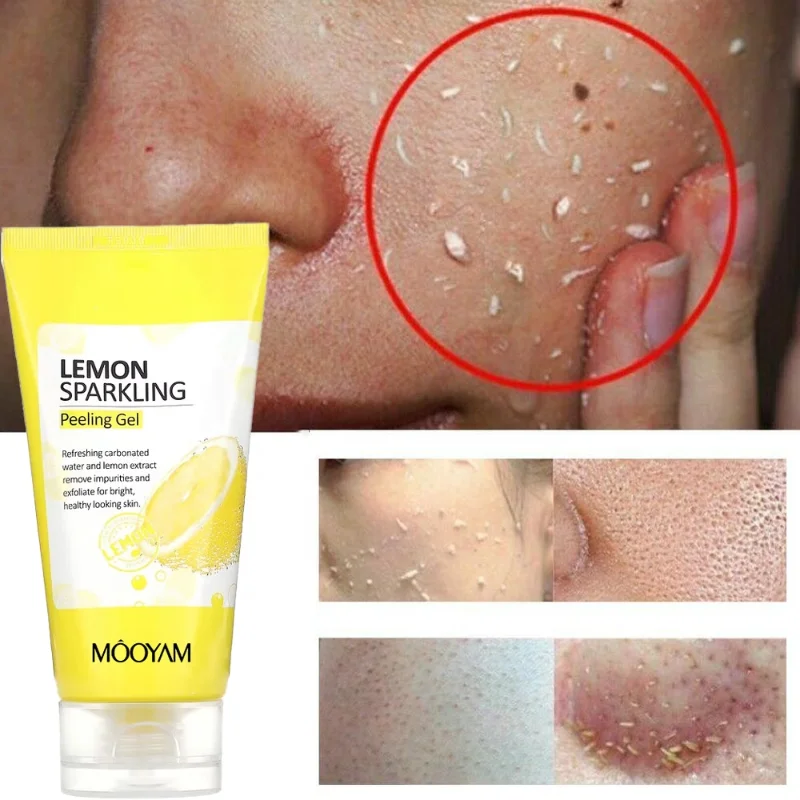 Gel exfoliant citron : élimine peaux mortes. – Test et Avis