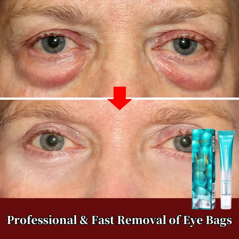 « La crème magique des yeux parfaits » – Test et Avis