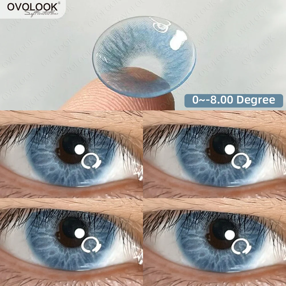 « Lentilles OVOLOOK pour correction de myopie » – Test et Avis