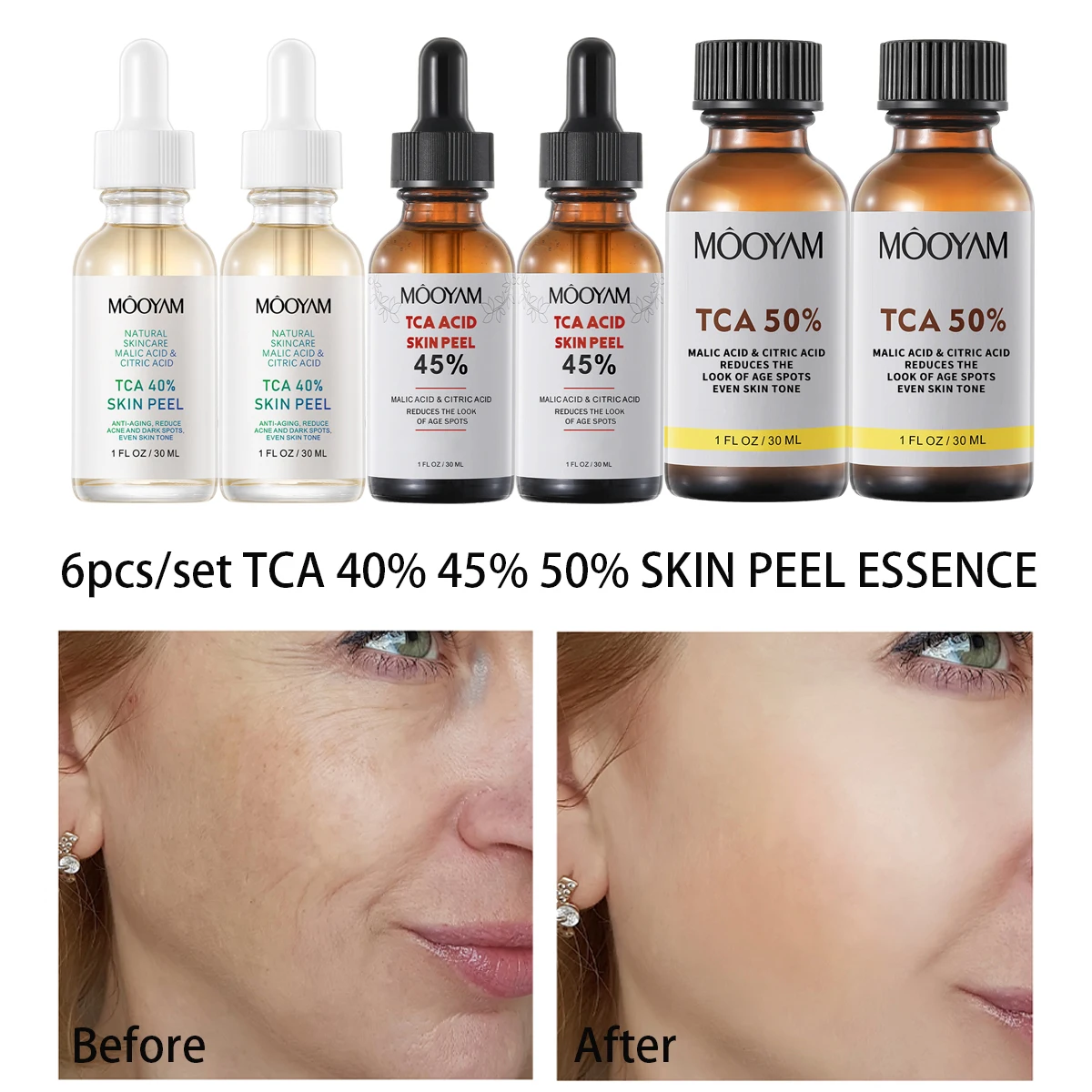 Peeling chimique visage, ensemble soins peau – Test et Avis