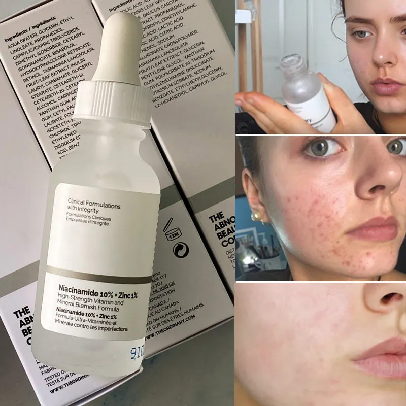 Sérum Niacinamide 10% + Zinc 1% – Test et Avis