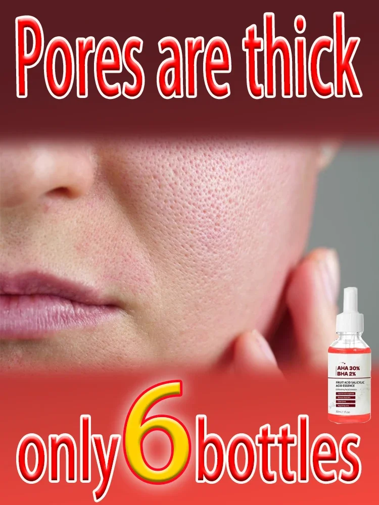 Sérum anti-rides et soins de peau. – Test et Avis