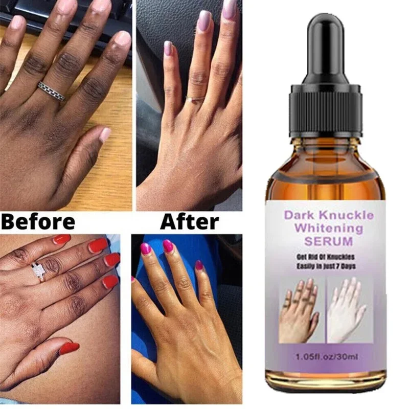 « Sérum éclaircissant pour peau noire » – Test et Avis