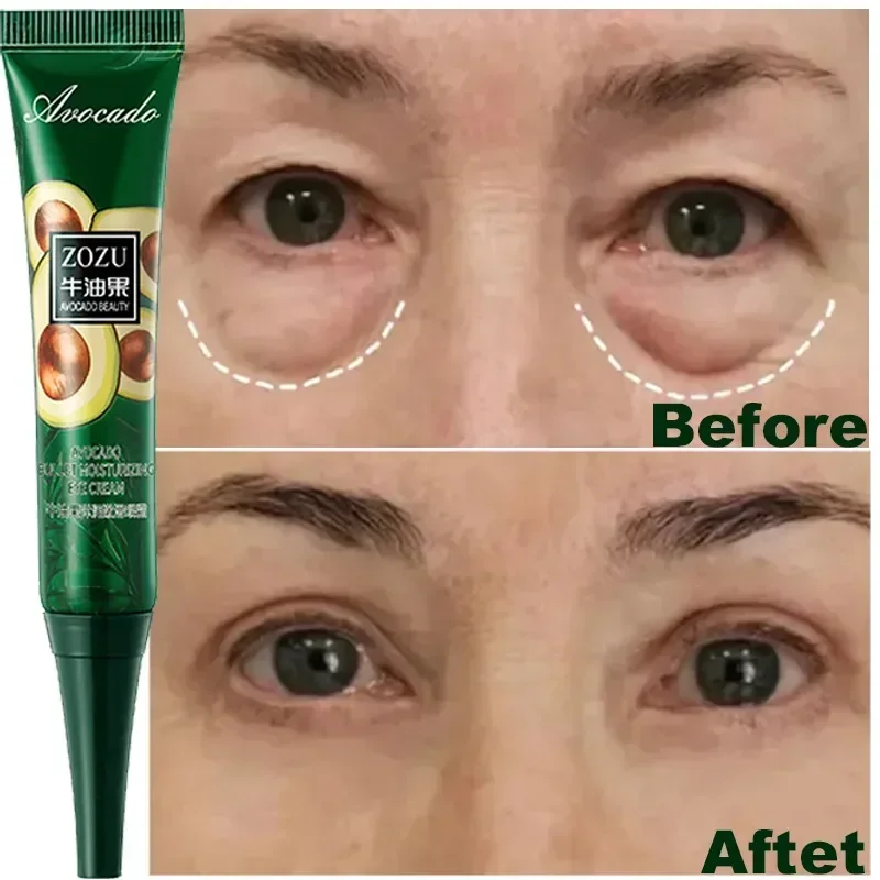 Soins coréens pour les yeux foncés. – Test et Avis