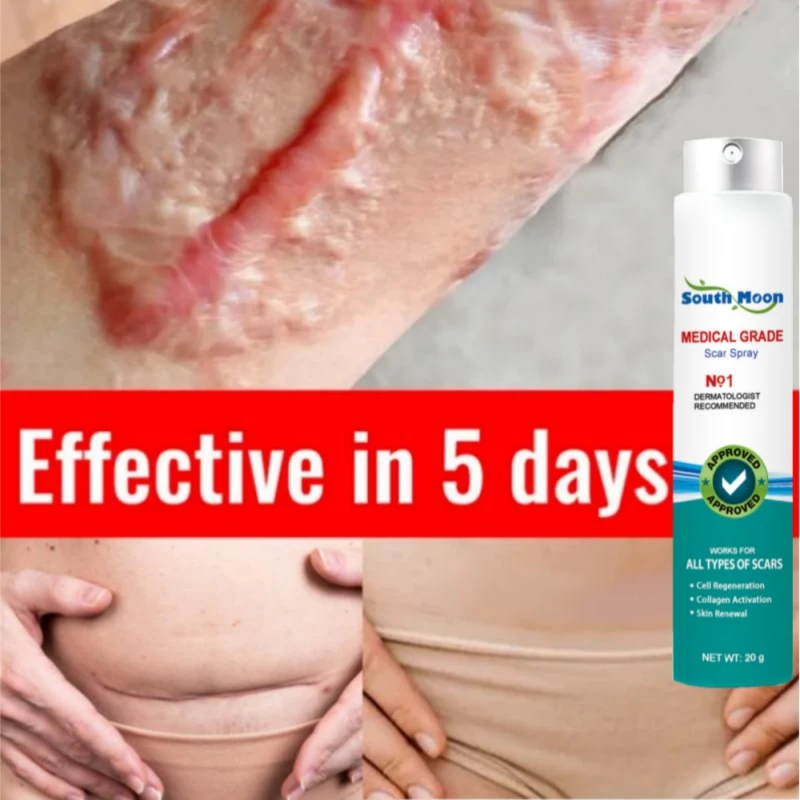 Soins pour la peau et cicatrices. – Test et Avis