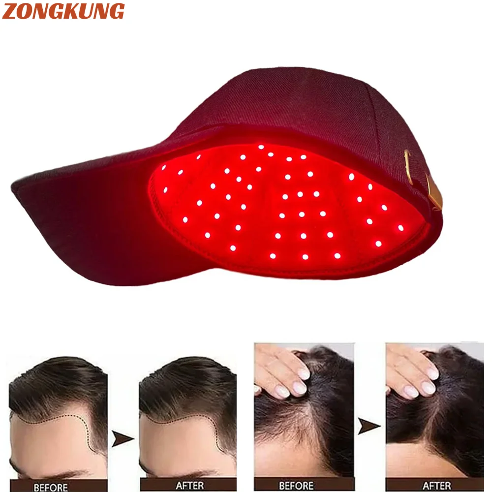 Casquette thérapie croissance cheveux infrarouge rouge – Test et Avis