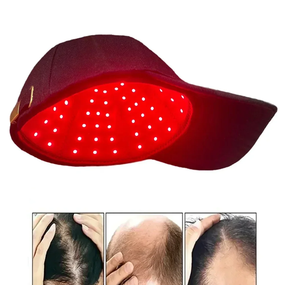 Thérapie capillaire à lumière rouge. – Test et Avis